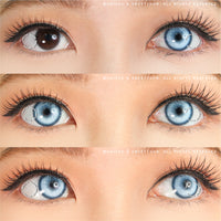Sweety Koi Blue - With Prescription